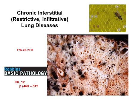 Chronic Interstitial (Restrictive, Infiltrative) Lung Diseases