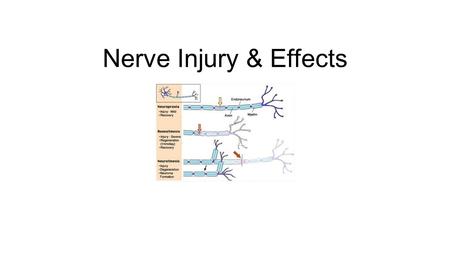 Nerve Injury & Effects.