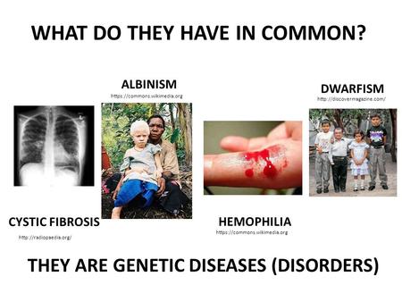 CYSTIC FIBROSIS ALBINISM HEMOPHILIA DWARFISM WHAT DO THEY HAVE IN COMMON? THEY ARE GENETIC DISEASES (DISORDERS)  https://commons.wikimedia.org.