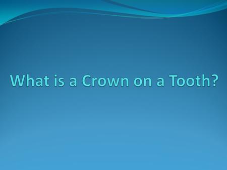 When Dr. Madhuri Vanama of Discovery Dental recommends a tooth crown, many patients feel confused about what this means. “What is a crown on a tooth?”