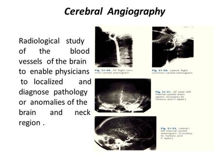 Cerebral Angiography Radiological study of the blood vessels of the brain to enable physicians to localized and diagnose pathology or anomalies of the.
