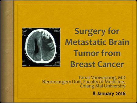 Surgery for Metastatic Brain Tumor from Breast Cancer