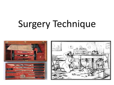 Surgery Technique. 1) What can you learn from Source A about surgery in the early 1840s? (6) 2 supported inferences. Lead with inference, not example.