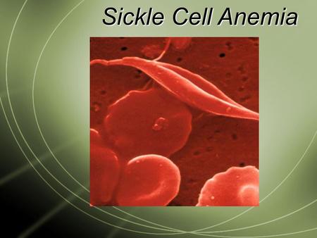 Sickle Cell Anemia Introduction Hereditary disease Hereditary disease Blood disorder Blood disorder Mutation in the Hemoglobin Beta Gene Mutation in.