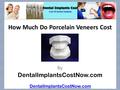 How Much Do Porcelain Veneers Cost DentalImplantsCostNow.com By.