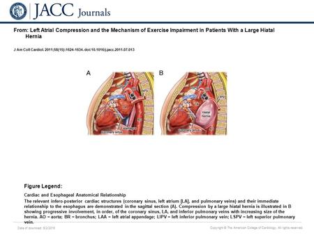 Date of download: 6/2/2016 Copyright © The American College of Cardiology. All rights reserved. From: Left Atrial Compression and the Mechanism of Exercise.