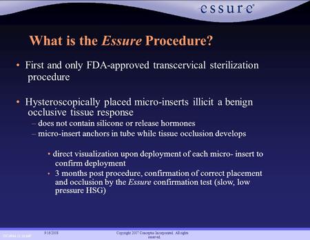 CC-0944 11.16.04F Copyright 2007 Conceptus Incorporated. All rights reserved. 9/16/2008 What is the Essure Procedure? First and only FDA-approved transcervical.