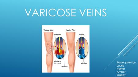Varicose Veins Power point by: Laurie Harriet Amber Gabby.