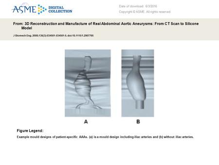 Date of download: 6/3/2016 Copyright © ASME. All rights reserved. From: 3D Reconstruction and Manufacture of Real Abdominal Aortic Aneurysms: From CT Scan.