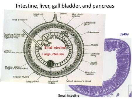 32409 Small intestine Large intestine Small intestine Intestine, liver, gall bladder, and pancreas.