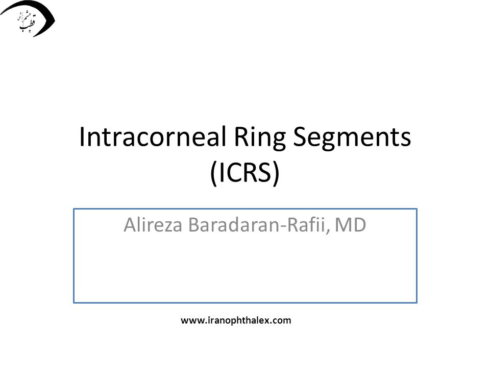 Intracorneal Ring Segments (ICRS) - ppt video online download