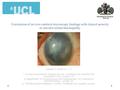 Correlation of in-vivo confocal microscopy findings with clinical severity of aniridia related keratopathy. Mandal N 1 Shortt A.J. 1,2,3 1. Cornea and.