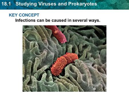 18.1 Studying Viruses and Prokaryotes KEY CONCEPT Infections can be caused in several ways.