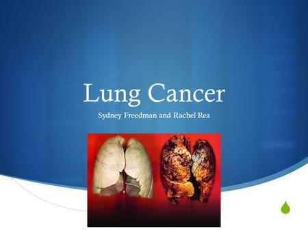 Lung Cancer Sydney Freedman and Rachel Rea. Causes  No exact cause  Smokers and non-smokers can get lung cancer  Smoke causes cancer by damaging.