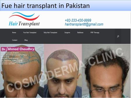 Fue hair transplant in Pakistan. About us Fue hair transplant clinic Pakistan Follicular Unit Extraction or Fue hair transplant in Pakistan is a most.
