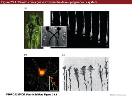 Figure 23.1 Growth cones guide axons in the developing nervous system.