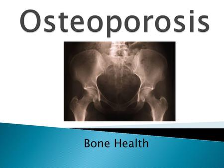 Osteoporosis Bone Health.
