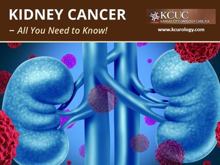 Kidney Cancer – All You Need to Know!