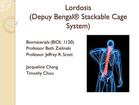 Lordosis (Depuy Bengal® Stackable Cage System)