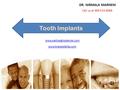 DR. NIRMALA MARNENI Call us at 469 513-8066 Tooth Implants www.oakheightsdental.com www.bracesdallas.com.