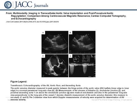 Date of download: 6/29/2016 Copyright © The American College of Cardiology. All rights reserved. From: Multimodality Imaging in Transcatheter Aortic Valve.