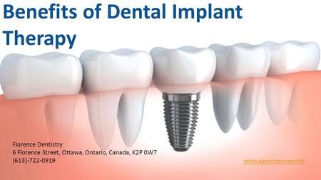 Benefits of Dental Implant Therapy Are you sad with your smile? Are your tooth hindering your day-to-day existence? The good news is that you don’t have.