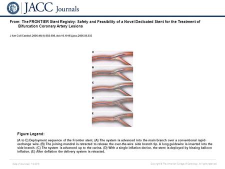 Date of download: 7/3/2016 Copyright © The American College of Cardiology. All rights reserved. From: The FRONTIER Stent Registry: Safety and Feasibility.
