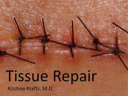 Tissue Repair Kristine Krafts, M.D.. Tissue repair = restoration of tissue architecture and function after an injury Occurs in two ways: Regeneration.