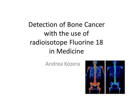 Detection of Bone Cancer with the use of radioisotope Fluorine 18 in Medicine Andrea Kozera.