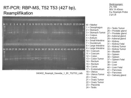 RT-PCR: RBP-MS, T52 T53 (427 bp), Reamplifikation 040402_Reampli_Gewebe_1_B1_T52T53_calb Bedingungen: 2% TBE 90V 1h 45min 9 µ Reampli-Probe 2 µl LB M 1.
