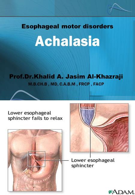 Esophageal motor disorders Achalasia Prof.Dr.Khalid A. Jasim Al-Khazraji M.B.CH.B, MD, C.A.B.M, FRCP, FACP.