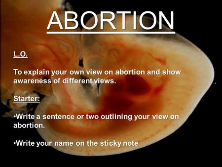ABORTIONL.O. To explain your own view on abortion and show awareness of different views. Starter: Write a sentence or two outlining your view on abortion.Write.