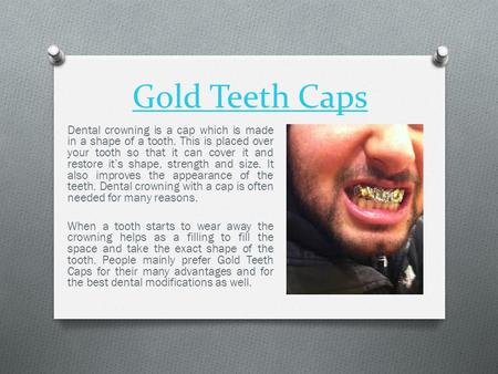 Gold Teeth Caps Dental crowning is a cap which is made in a shape of a tooth. This is placed over your tooth so that it can cover it and restore it’s shape,