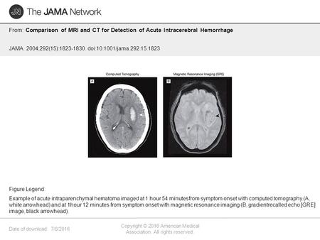 Date of download: 7/8/2016 Copyright © 2016 American Medical Association. All rights reserved. From: Comparison of MRI and CT for Detection of Acute Intracerebral.