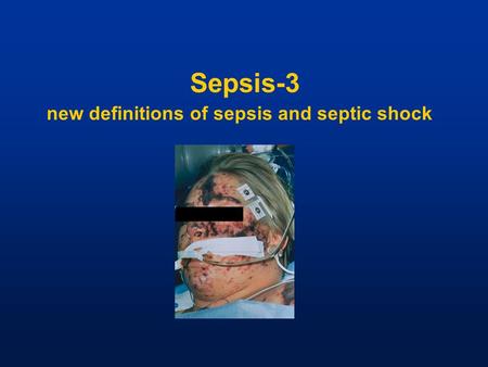 Sepsis-3 new definitions of sepsis and septic shock
