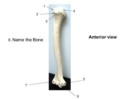 1 4 2 3 Anterior view 8. Name the Bone 5 7 6.