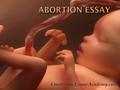 If you are to write an essay on abortion, narrow this topic according to your interests.