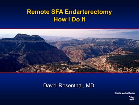Remote SFA Endarterectomy