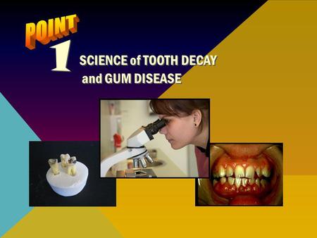 1 SCIENCE of TOOTH DECAY POINT and GUM DISEASE