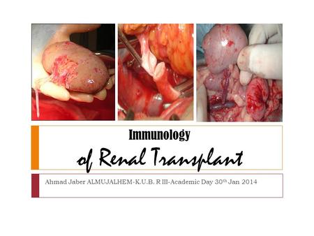 Immunology of Renal Transplant