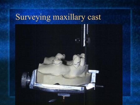 Surveying maxillary cast