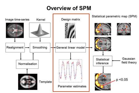 Overview of SPM p <0.05 Statistical parametric map (SPM)