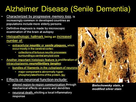 Alzheimer Disease (Senile Dementia) Characterized by progressive memory loss, is increasingly common in developed countries as populations include more.