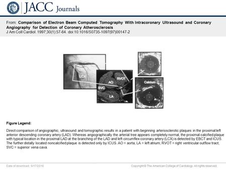 Date of download: 9/17/2016 Copyright © The American College of Cardiology. All rights reserved. From: Comparison of Electron Beam Computed Tomography.