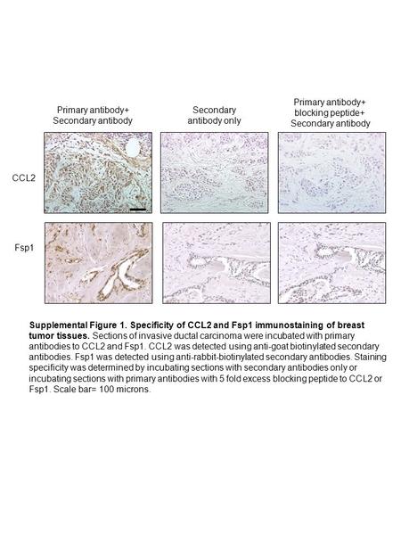 Supplemental Figure 1. Specificity of CCL2 and Fsp1 immunostaining of breast tumor tissues. Sections of invasive ductal carcinoma were incubated with primary.