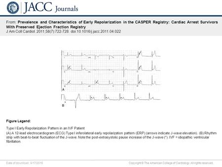 Date of download: 9/17/2016 Copyright © The American College of Cardiology. All rights reserved. From: Prevalence and Characteristics of Early Repolarization.