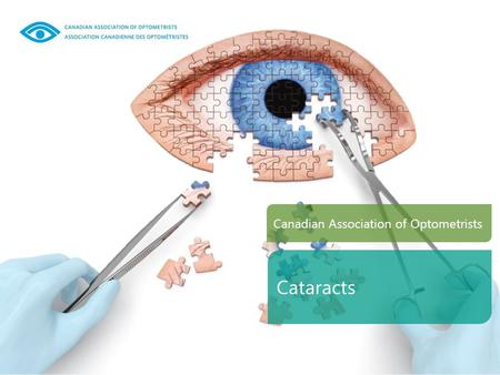 Canadian Association of Optometrists Cataracts. What are Cataracts? More than 2.5 Million Canadians have cataracts With age, the lens of the eye hardens.
