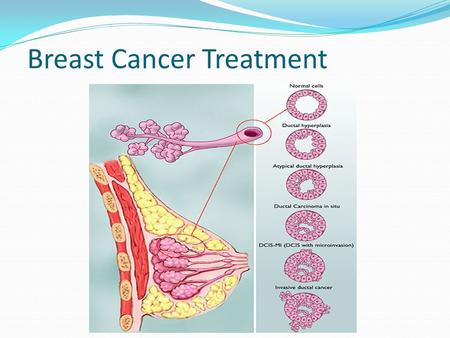 Breast Cancer Treatment. Treatment 2 aspects 1. Treatment of the breast itself: “Local Treatment” 2. Treatment of the whole body = “Systemic treatment”