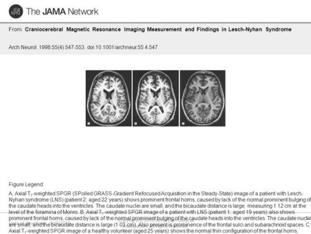 Date of download: 9/18/2016 Copyright © 2016 American Medical Association. All rights reserved. From: Craniocerebral Magnetic Resonance Imaging Measurement.