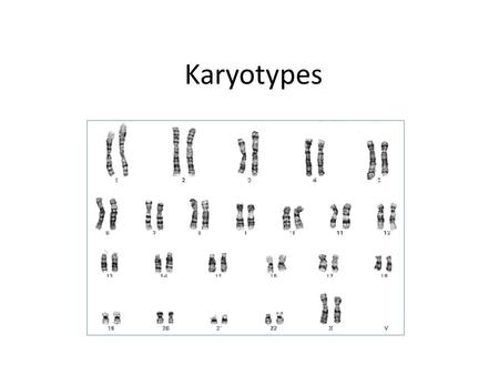 Karyotypes. How karyotypes are made…  sist_safety_mode=1&safe=active.